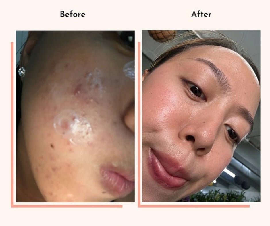 Hyperpigmentation Fix supplement