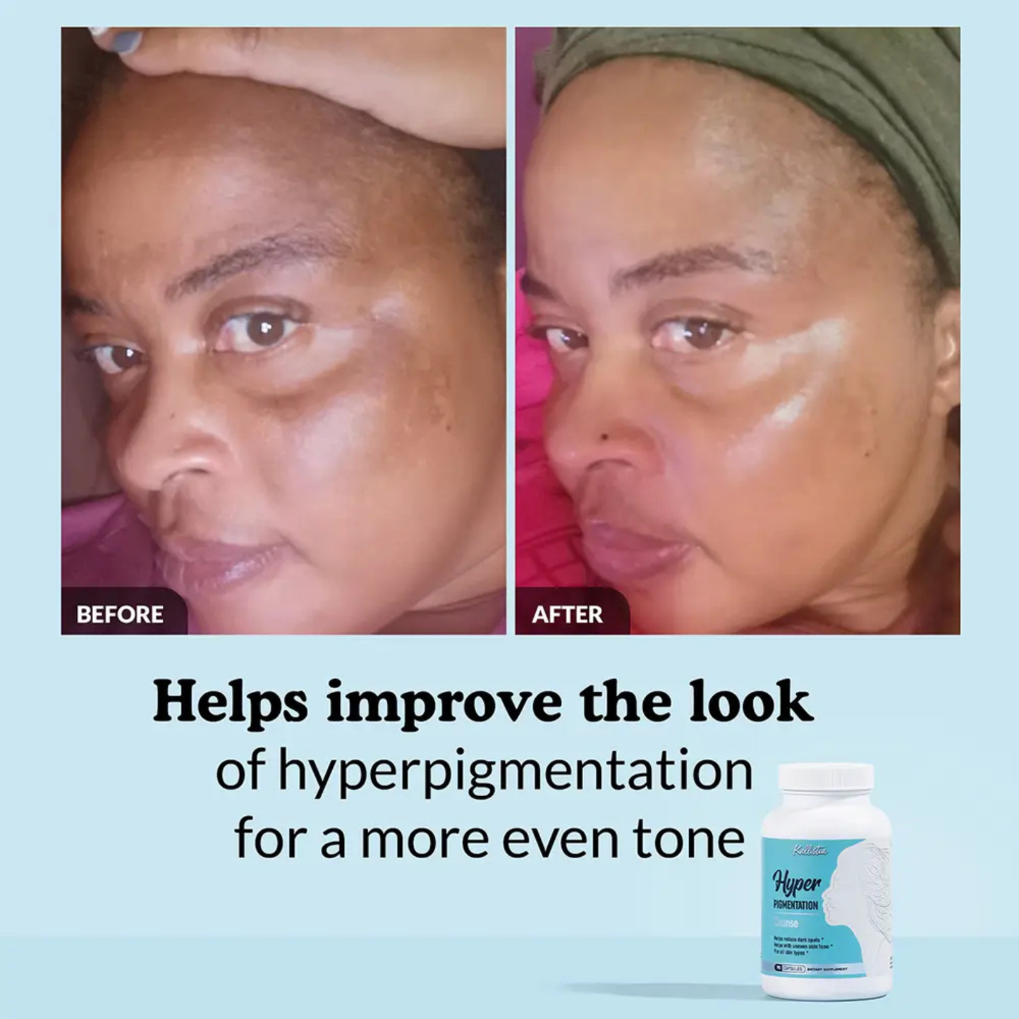 Hyperpigmentation Fix supplement