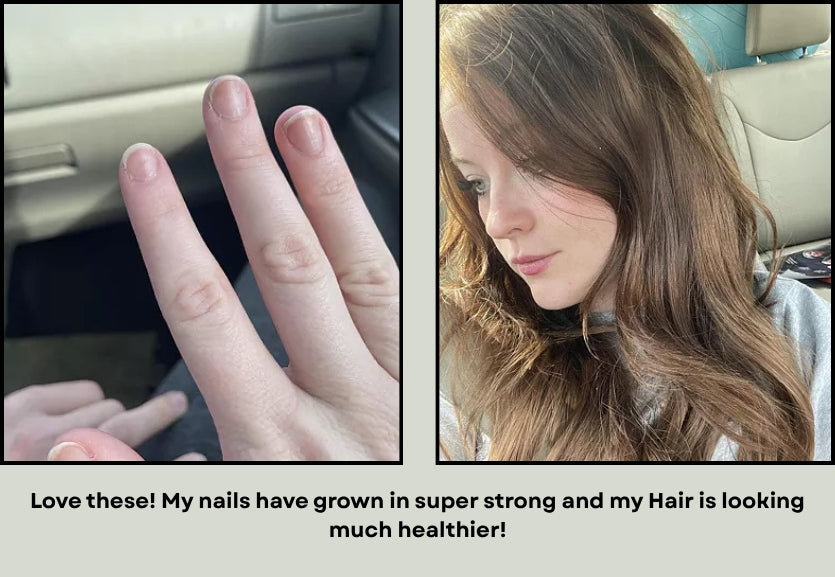Hair, skin and nails (Collagen and biotin supplement)