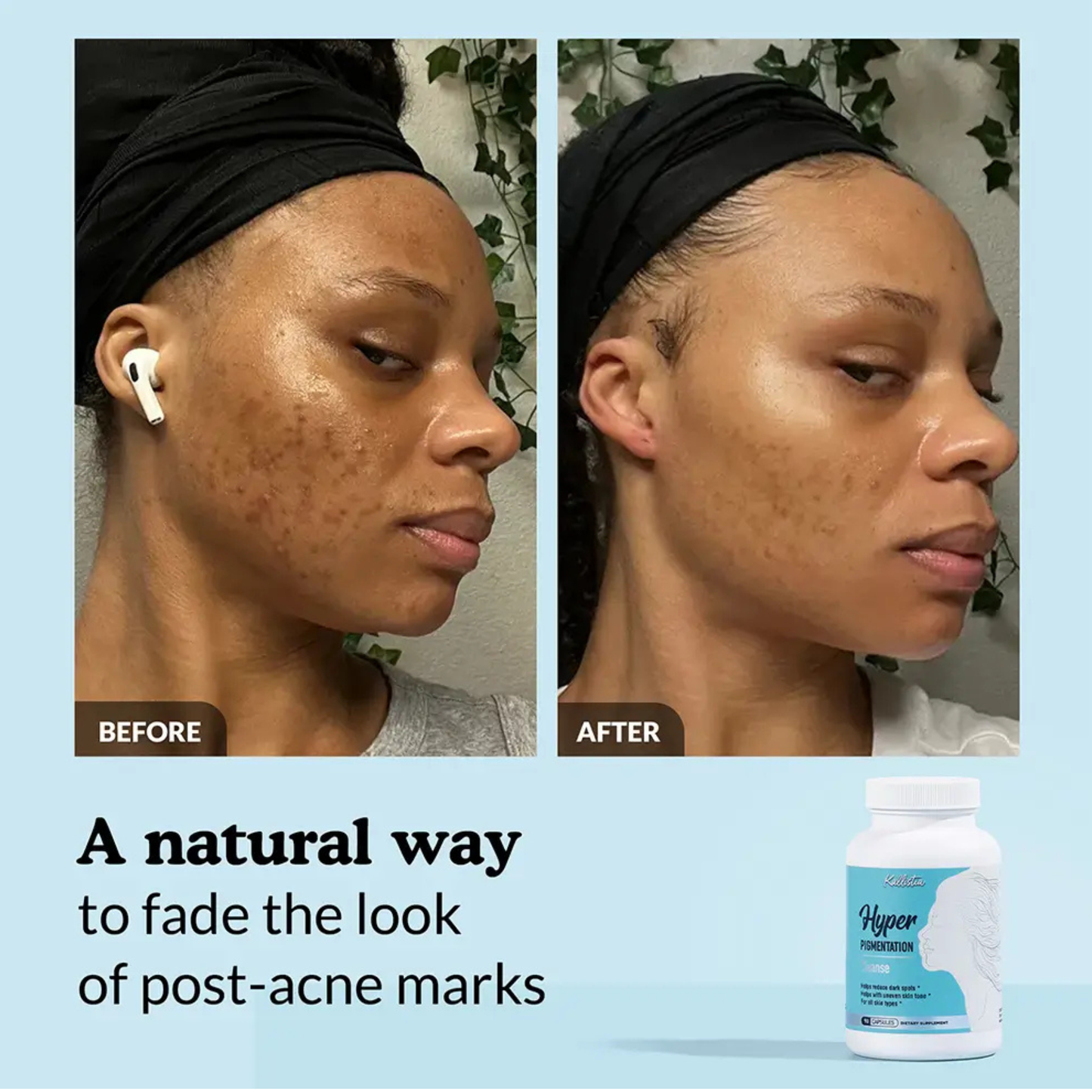 Hyperpigmentation Fix supplement