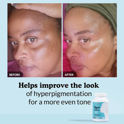 Hyperpigmentation Fix supplement
