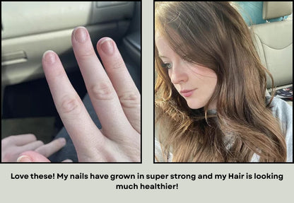 Hair, skin and nails (Collagen and biotin supplement)
