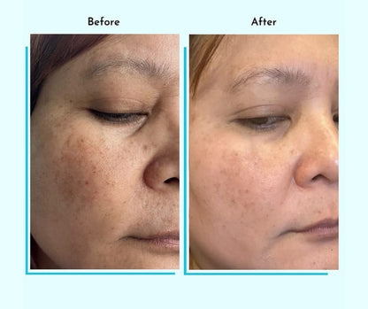 Hyperpigmentation Fix supplement