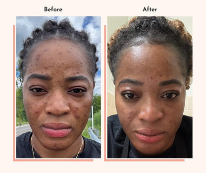 Hyperpigmentation Fix supplement